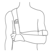 Push Schulterfixationsbandagen Illustration