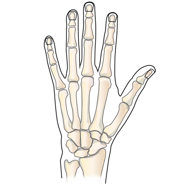 Почему болит кость пальца. Ладонный фиброматоз Дюпюитрена. Пястно-запястный сустав большого пальца руки. Артрит запястно пястного сустава. Артрит лучезапястного сустава.